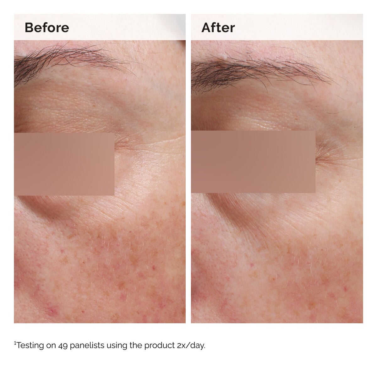 niacinamide-5-face-and-body-emulsion-l4 2024-08-23-ORD-Nia-5pct-Face-Body-B-A-Elasticity-Global-02-1x1.jpg