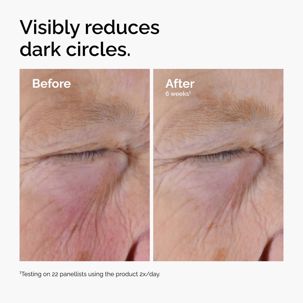 caffeine-solution-5-egcg-eye-serum-c6 ord-caffeine-solution-egcg-dark-circles-before-after.jpg