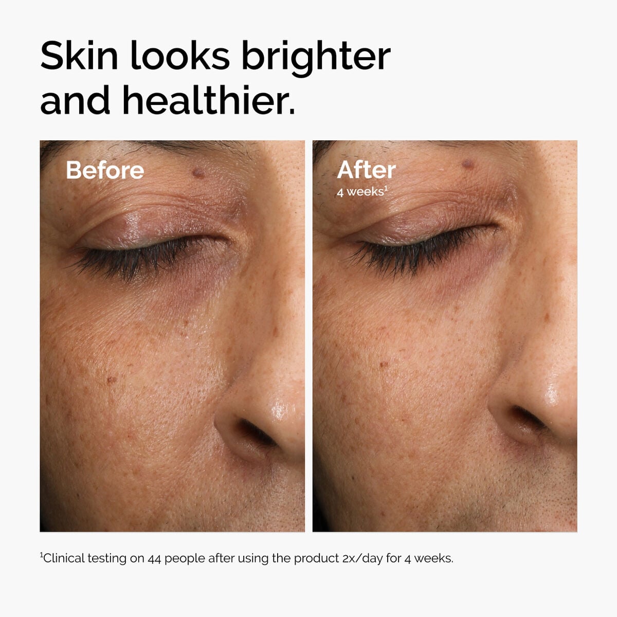 multi-antioxidant-radiance-serum-s5 ord-mars-before-after-healthy.jpg