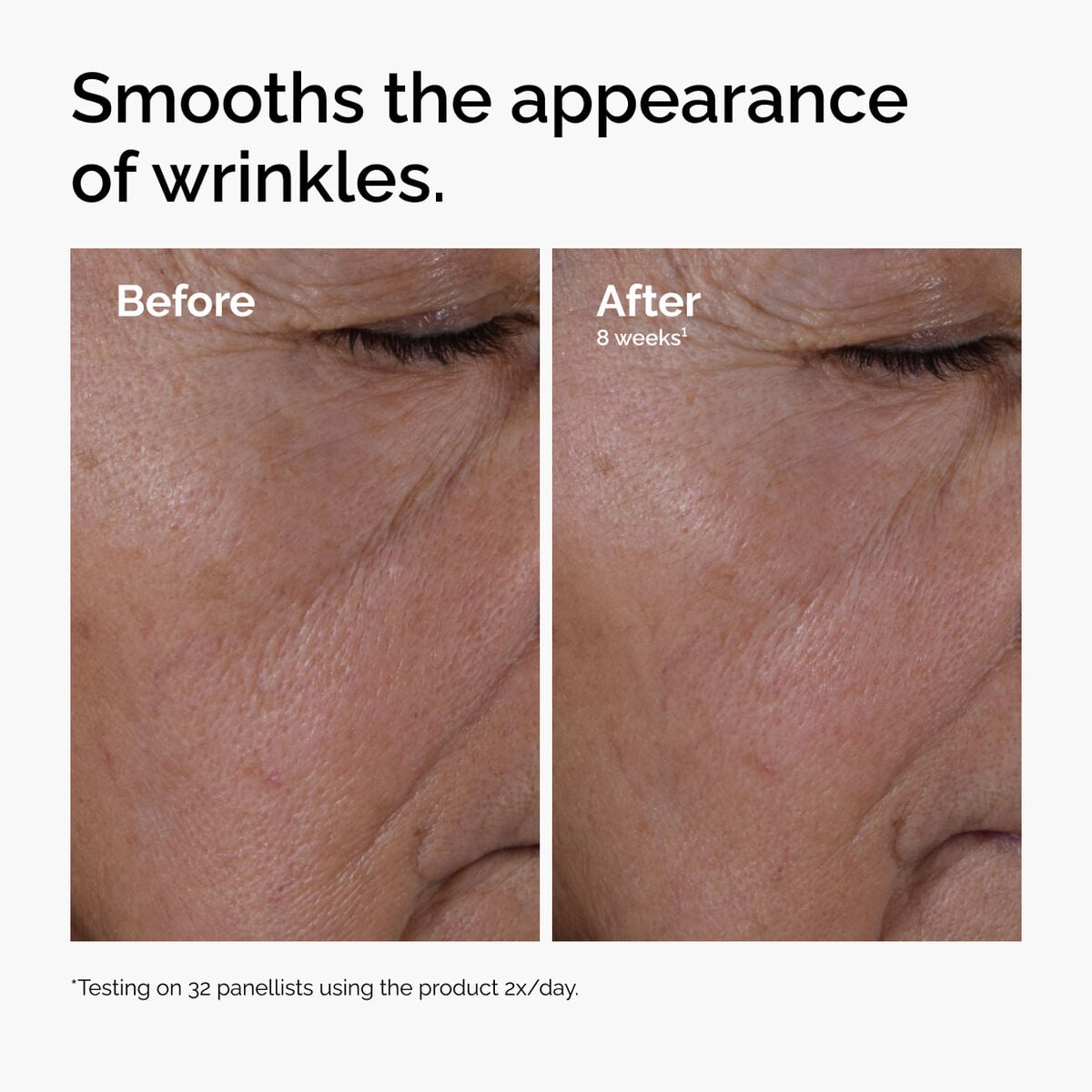 multi-peptide-ha-serum-t1 ord-multi-peptide-ha-serum-wrinkles-before-after.jpg