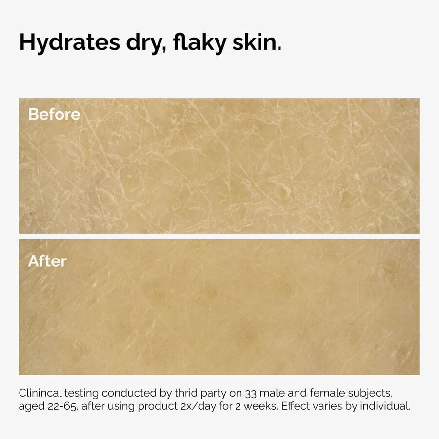 the-body-care-collection-t6 ord-natural-moisturizing-factors-inulin-body-before-after-graphic-02.jpg