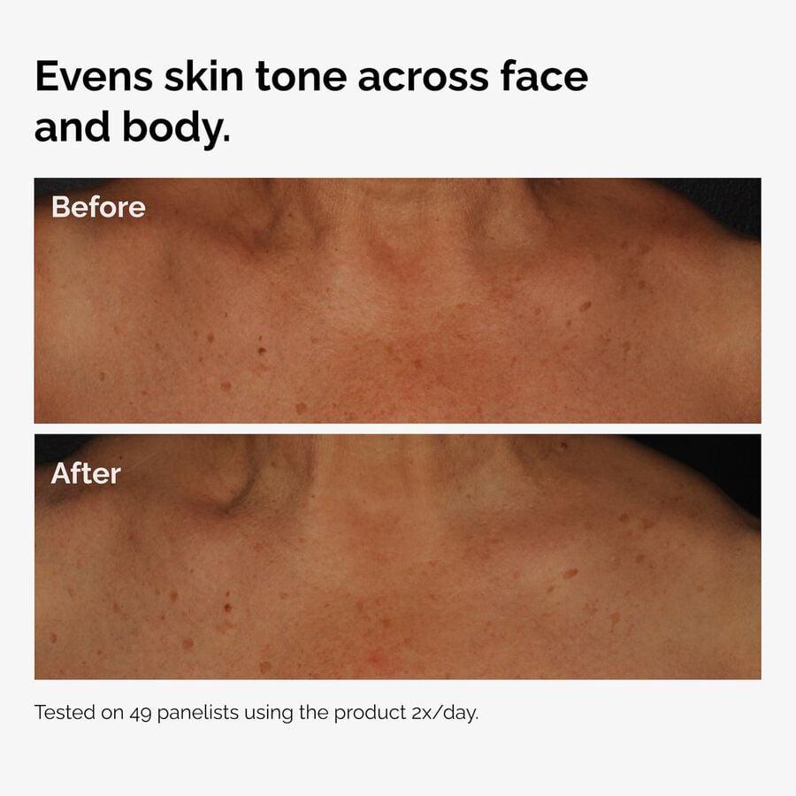 the-body-care-collection-t6 ord-niacinamide-face-body-serum-before-after-even-tone-graphic.jpg