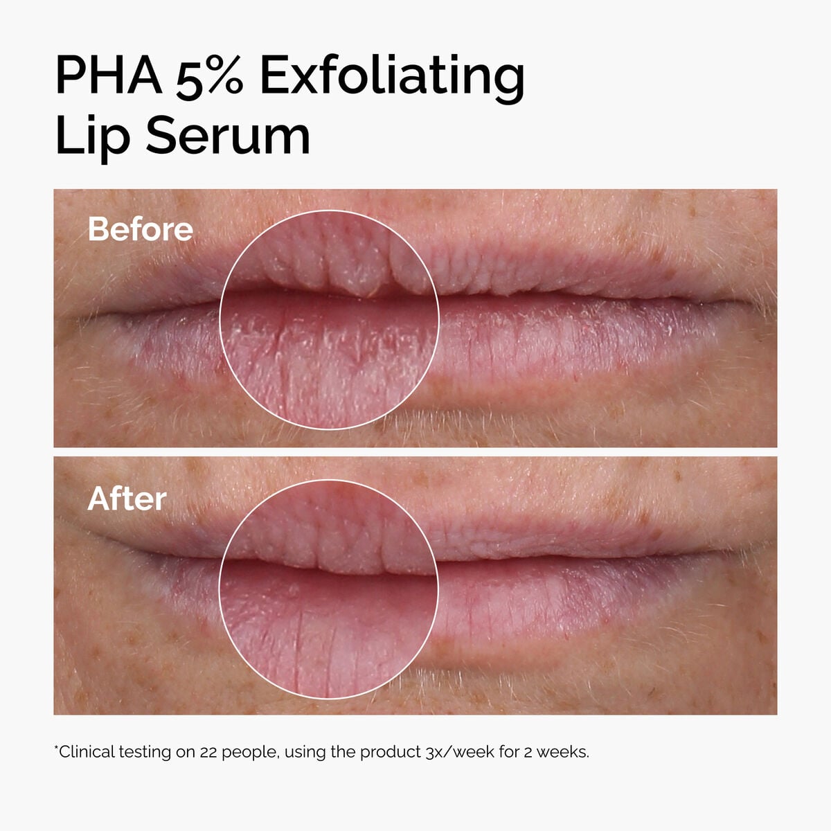 pha-5-exfoliating-lip-serum-a6 ord-pha-5pct-lip-exfoliating-serum-before-after.jpg